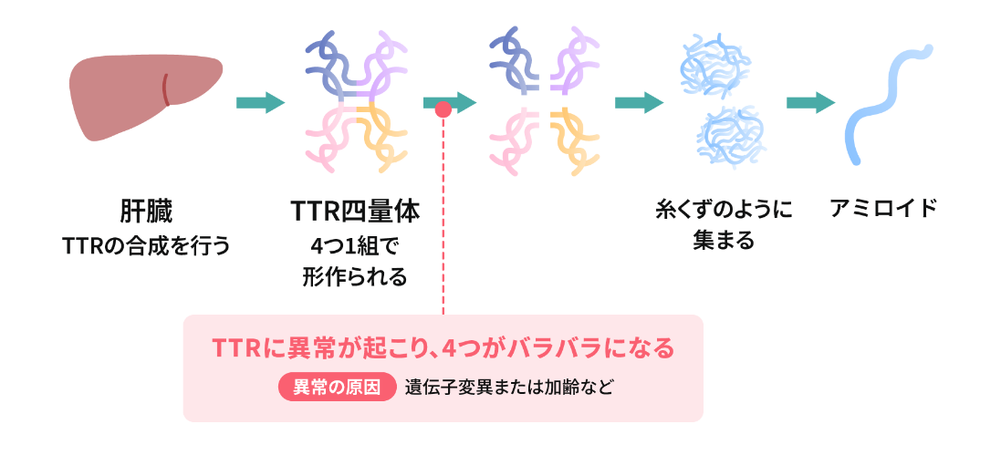 トランスサイレチン型心アミロイドーシスとは