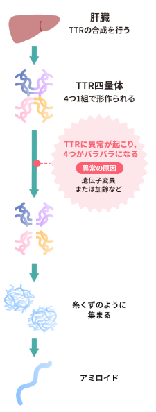 トランスサイレチン型心アミロイドーシスとは