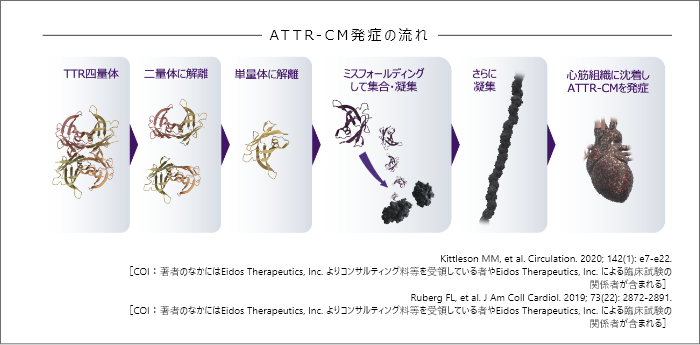 ATTR-CM発症の流れKittleson MM, et al. Circulation. 2020; 142(1): e7-e22.                 ［COI：著者のなかにはEidos Therapeutics, Inc. よりコンサルティング料等を受領している者やEidos Therapeutics, Inc. による臨床試験の関係者が含まれる］Ruberg  FL, et al. J Am Coll Cardiol. 2019; 73(22):  2872-2891.［COI：著者のなかにはEidos Therapeutics, Inc. よりコンサルティング料等を受領している者やEidos  Therapeutics,  Inc.  による臨床試験の関係者が含まれる］